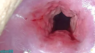 Uncensored Japanese Cervix Stretching and Uterus Dilation with Bottomless pit